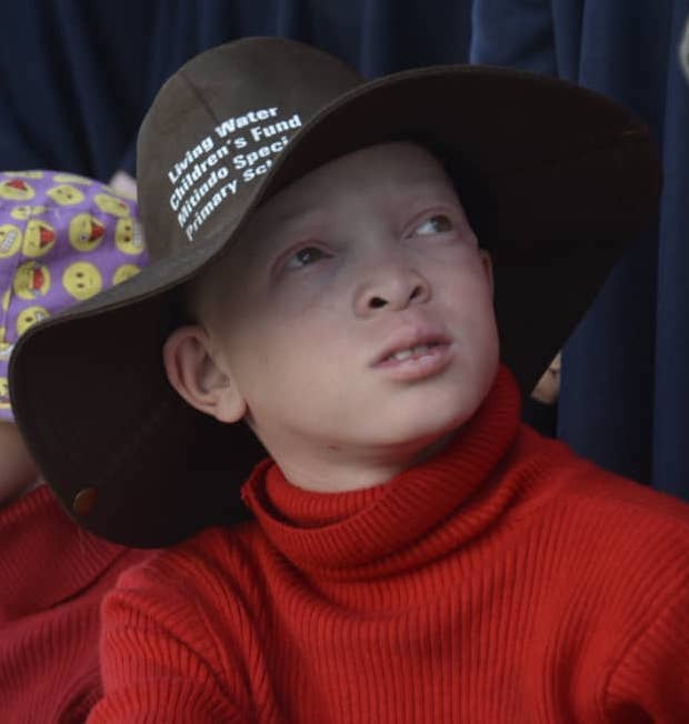Photo of a child at the Mitindo school wearing Living Water Children's Fund sponsored protective clothing designed for children with Albinism.